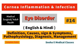 Cornea inflammation and infection  Keratitis  Hindi [upl. by Ehman]