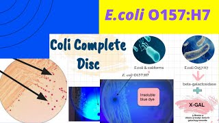 Ecoli O157H7 A Foodborne pathogenEnrichment amp IsolationEEBSMAC TSYEEMB and Coli complete Disc [upl. by Hedva576]