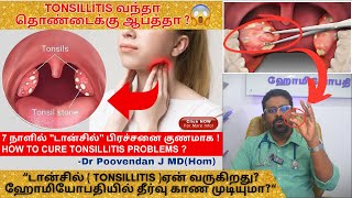 அறுவை சிகிச்சையின்றி டான்சில் Tonsillitis குணப்படுத்த முடியுமாடான்சில் நீக்கினால் என்ன நடக்கும் [upl. by Skillern]