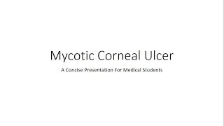 Mycotic Corneal Ulcer  Fungal Keratitis  Ophthalmology For Medical Students [upl. by Jojo]