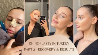 Rhinoplastynose job experience in Turkey vlog pt 2  surgery recovery amp results  Dr Orhan Ucal [upl. by Isolde]