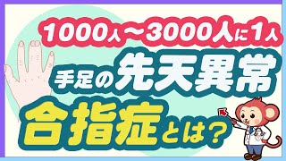 【意外と多い】手足の先天性異常の合指症を医師監修で詳しく解説 [upl. by Ludwig448]