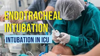 Endotracheal intubation Step by step procedure [upl. by Ahserak]