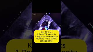 What is tricuspid regurgitation echocardiography [upl. by Doone]