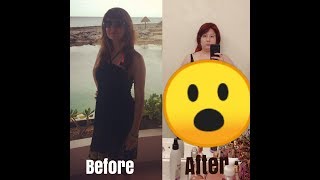 50 POUND WEIGHT GAIN FROM ANXIETY MEDS [upl. by Earized852]