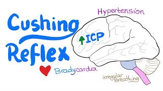 Cushing Reflex  Cushing Triad  Intracranial Hypertension  Emergency Medicine and EMS EMT [upl. by Mihcaoj801]