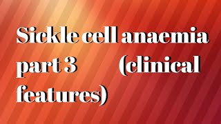 sickle cell anaemia part 3clinical features of sickle cell anaemia [upl. by Florina]