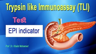 Trypsin like Immunoassay TLI [upl. by Euqinahs]