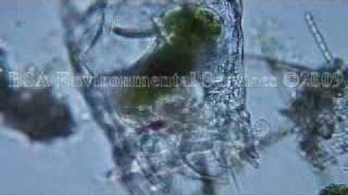 Brachionus patulus feeding Zooplankton Rotifer [upl. by Tigram51]