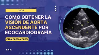 🎯Como obtener la 🎨VISION DE AORTA ASCENDENTE por ECOCARDIOGRAFÍA Guía paso a paso [upl. by Wieren]