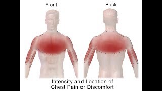 Distinguishing Types of Chest Pain [upl. by Lein]