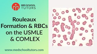 Rouleaux Formation amp RBCs on the USMLE [upl. by Lanita]