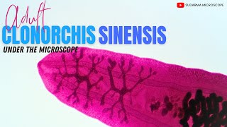 Adult Clonorchis sinensis under the microscope [upl. by Nyahs]