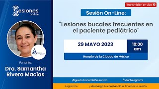 Sesión OnLine quotLesiones bucales frecuentes en el paciente pediátricoquot [upl. by Irahc]