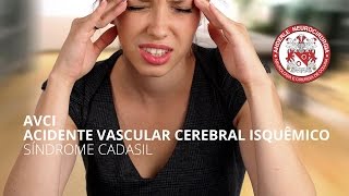 AVCI  ACIDENTE VASCULAR CEREBRAL ISQUÊMICO  Síndrome CADASIL [upl. by Delisle]