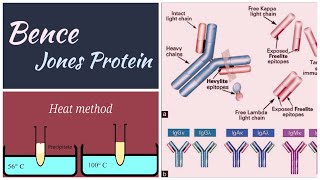 Bence jones protein  multiple myeloma  Methodspathologypathologylabbiochemistry bjp [upl. by Silletram175]