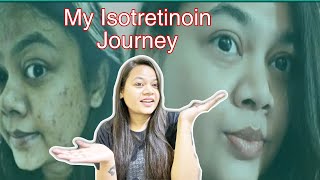 ISOTRETINOIN TABLETS Update after 1 Year  Does isotretinoin remove acne permanently [upl. by Aekerly]