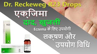 R23 Drops For Eczema  दाद खाज खुजली और चर्मरोग को दूर करने में असरदार  Medicine Media [upl. by Ihculo]