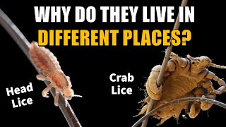 Where Did PubicCrab amp Body Lice Come From  The Coevolution of Lice [upl. by Kalin]