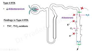 RTA Renal Tubular Acidosis [upl. by Hsemin]