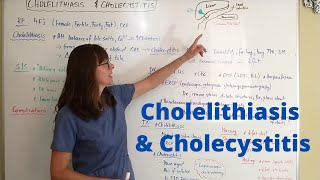 Cholelithiasis amp Cholecystitis [upl. by Donald]