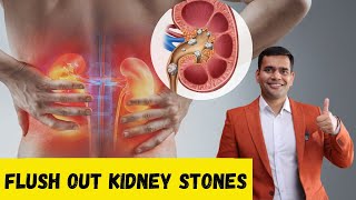 Dissolve Kidney stones Naturally  Flush Out Kidney Stones  Dr Vivek Joshi [upl. by Trudie]