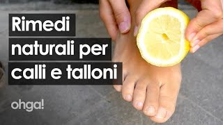 Rimedi naturali per calli e talloni screpolati dal bicarbonato allaceto di vino [upl. by Oileve273]