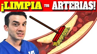 El INCREIBLE METODO que LIMPIA tus ARTERIAS RAPIDAMENTE Colesterol [upl. by Brenda]