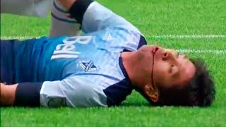 14 JOGADORES DE FUTEBOL QUE QUASE MORRERAM EM CAMPO [upl. by Erbma699]