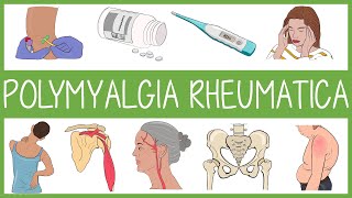 Polymyalgia Rheumatica [upl. by Dysart214]