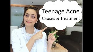 Teenage Acne causes amp treatment [upl. by Brena]