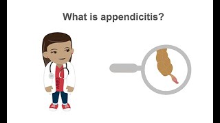 Diagnosing acute appendicitis [upl. by Bertha715]