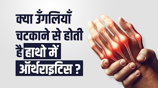 क्या उँगलियाँ चटकने से होती है हाथो में ऑर्थराइटिस  Does Cracking Fingers cause Arthritis [upl. by Zertnom782]