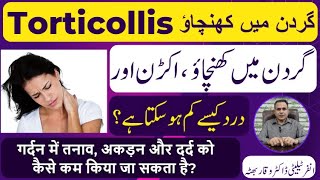 Torticollis گردن میں کھنچاؤ मन्यास्तंभ Homeopathic Treatmennt By Dr Waqar Bhutta In Urdu  Hindi [upl. by Ewald114]