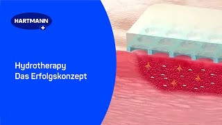 Hydrotherapy  Das Erfolgskonzept [upl. by Ermeena]