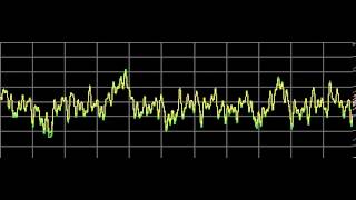 Candidiasis Candida Albicans  Rife Frequencies [upl. by Cruickshank]