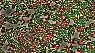 Dueling between green Pseudomonas aeruginosa cells ClpVGFP and killing of [upl. by Waldman]