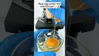 Raw egg under the microscope🥚🔬 health shorts [upl. by Abebi797]