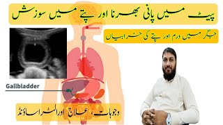 Gallbladder wall thickness Hindi Urdu [upl. by Danya]