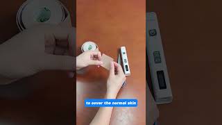 How to cover the normal skin during vitiligo uv treatment vitiligotreatment [upl. by Ytnom]