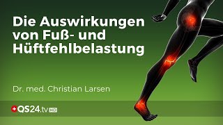 Knieprobleme vermeiden Die Bedeutung von Fuß und Hüftausrichtung  Dr Christian Larsen  QS24 [upl. by Retsae711]