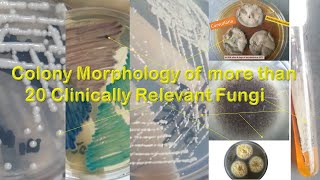 Fungal Colony morphology of more than twenty most common fungi [upl. by Mahseh]