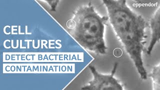 How to detect bacterial contamination in cell culture  moving particles are not always bacteria [upl. by Donelle211]