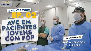 4 Valves Tour Ep 02  AVC em pacientes jovens com FOP Forame Oval Patente  CuiabáBR [upl. by Radford1]