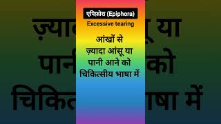 एपिफ़ोराEpiphoraExcessive tearingएपिफोरा का अर्थ क्या हैWhat is epiphora of the eye [upl. by Tlaw368]