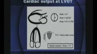 Basics Of Echocardiography Part2series2 [upl. by Aydne]