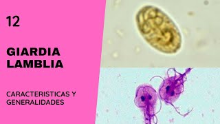 Giardia Lamblia 12  Giardiasis  Parasitología  Flagelados [upl. by Alvar676]