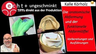 Von der anatomischen Abformung zum funktionellen Löffel [upl. by Roana578]