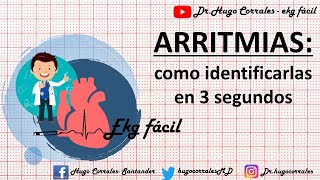 ARRITMIAS CARDÍACAS  como identificarlas en 3 segundos [upl. by Ayim]