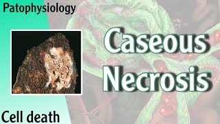 Pathophysiology  Caseous Necrosis Hani Laith شرح [upl. by Yelyac]